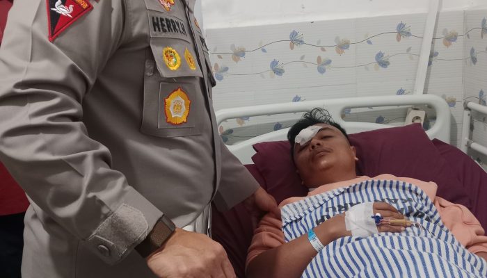 Kapolda Riau Jenguk Korban Pengeroyokan, Tegaskan Kasus Diusut Tuntas Tanpa Pandang Bulu